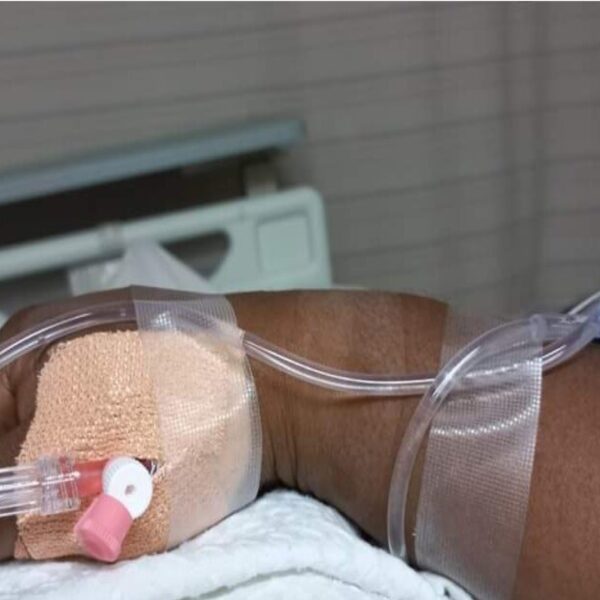 Special report: Bertha’s battle with breast cancer